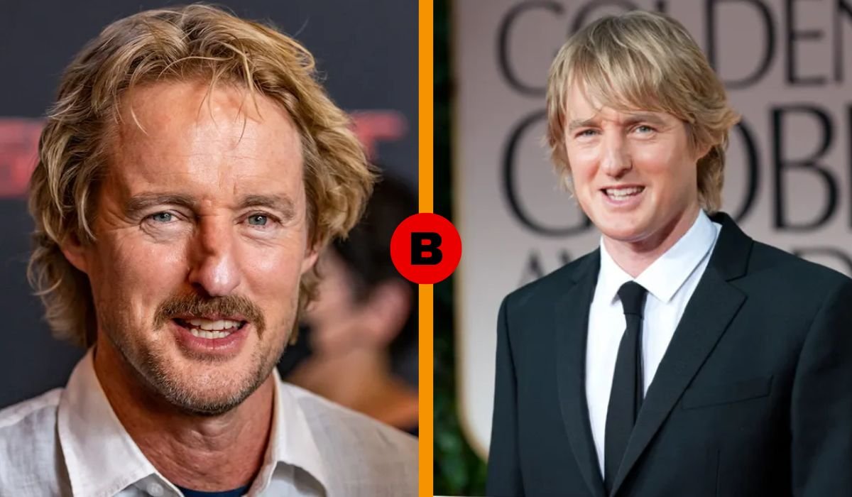 owen wilson nose