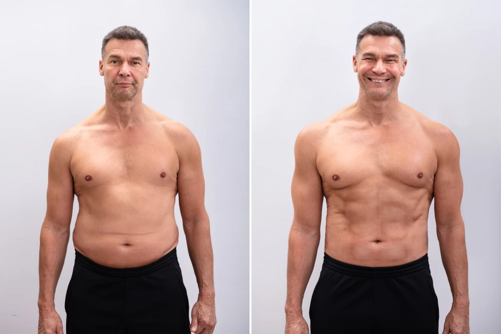 Testosterone Therapy on the Gold Coast:
